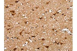 The image on the left is immunohistochemistry of paraffin-embedded Human brain tissue using ABIN7131195(SSBP4 Antibody) at dilution 1/25, on the right is treated with fusion protein. (SSBP4 anticorps)