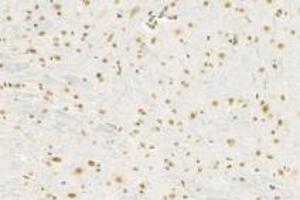 Immunohistochemistry analysis of paraffin-embedded mouse cerebellum using,RPAP2 (ABIN7075481) at dilution of 1: 1000