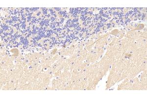 Detection of SPTAN1 in Human Cerebellum Tissue using Polyclonal Antibody to Alpha-Fodrin (SPTAN1)