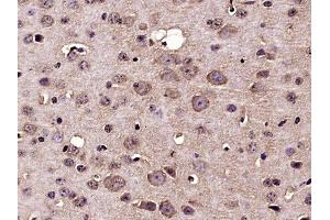 Paraformaldehyde-fixed, paraffin embedded mouse brain, Antigen retrieval by boiling in sodium citrate buffer (pH6) for 15min, Block endogenous peroxidase by 3% hydrogen peroxide for 30 minutes,  Blocking buffer (normal goat serum) at 37°C for 20min, Antibody incubation with Nucleoporin p62 Polyclonal Antibody(bs-2935R) at 1:400 overnight at 4°C, followed by a conjugated secondary and DAB staining.