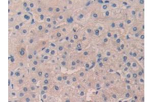 Used in DAB staining on fromalin fixed paraffin-embedded Kidney tissue (desert Hedgehog anticorps  (AA 241-383))