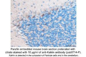 Image no. 1 for anti-Kalirin, RhoGEF Kinase (KALRN) (C-Term) antibody (ABIN559714) (KALRN anticorps  (C-Term))