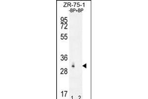 Western blot analysis of RAB40AL Antibdy (N-term) Pab (ABIN655950 and ABIN2845336) pre-incubated without(lane 1) and with(lane 2) blocking peptide in ZR-75-1 cell line lysate. (RAB40AL anticorps  (N-Term))