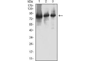 Western blot analysis using RRM1 mouse mAb against Hela (1), Jurkat (2), and A431 (3) cell lysate.