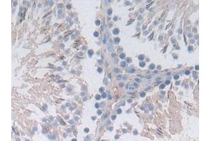 Detection of JNK1 in Rat Testis Tissue using Polyclonal Antibody to c-Jun N-terminal Kinase 1 (JNK1)