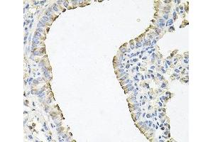 Immunohistochemistry of paraffin-embedded Mouse lung using SCNN1G Polyclonal Antibody at dilution of 1:100 (40x lens). (SCNN1G anticorps)