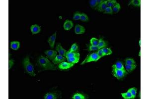 Immunofluorescent analysis of MCF-7 cells using ABIN7175441 at dilution of 1:100 and Alexa Fluor 488-congugated AffiniPure Goat Anti-Rabbit IgG(H+L)