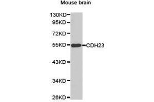Western Blotting (WB) image for anti-Cadherin 23 (CDH23) antibody (ABIN1871707) (CDH23 anticorps)