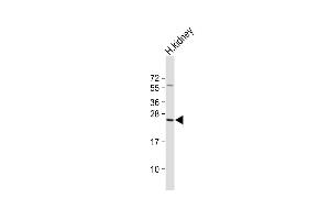 Anti-RAB28 Antibody (Center) at 1:1000 dilution + Human kidney lysate Lysates/proteins at 20 μg per lane. (RAB28 anticorps  (AA 119-147))