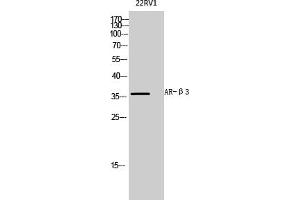 Western Blot analysis of 22RV1 cells using AR-β3 Polyclonal Antibody diluted at 1:1000. (ADRB3 anticorps  (AA 220-300))