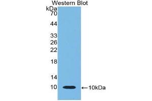 Western blot analysis of the recombinant protein. (beta-Thromboglobulin anticorps  (AA 46-107))