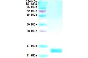 SDS-PAGE with Coomassie Blue staining