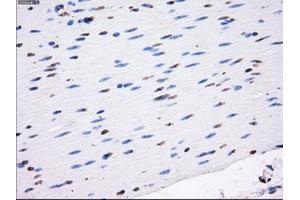 Immunohistochemical staining of paraffin-embedded colon tissue using anti-RC213323 mouse monoclonal antibody. (LOX anticorps  (AA 22-168))
