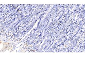 Detection of IL17 in Canine Small intestine Tissue using Polyclonal Antibody to Interleukin 17 (IL17)