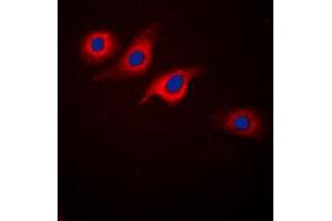 Immunofluorescent analysis of GLP-1 Receptor staining in SKNSH cells.