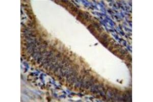 Immunohistochemistry analysis in human uterus tissue (Formalin-fixed, Paraffin-embedded) using Prothymosin alpha  Antibody (N-term), followed by peroxidase conjugated secondary antibody and DAB staining. (PTMA anticorps  (N-Term))