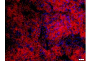 Paraformaldehyde-fixed, paraffin embedded mouse spleen, Antigen retrieval by boiling in sodium citrate buffer (pH6) for 15min, Block endogenous peroxidase by 3% hydrogen peroxide for 30 minutes, Blocking buffer (normal goat serum) at 37°C for 20min, Antibody incubation with 	IFN-Alpha Polyclonal Antibody, Unconjugated  at 1:200 overnight at 4°C, followed by a conjugated secondary Goat Anti-Rabbit IgG, Cy3 conjugated-Cy3)used at 1:200 dilution for 40 minutes at 37°C. (IFNA1 anticorps  (AA 150-189))