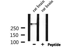 Western blot analysis of extracts from rat brain, using HECTD1 Antibody. (HECTD1 anticorps)