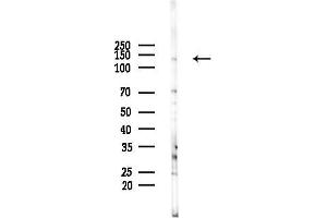 anti-Trafficking Protein Particle Complex 9 (TRAPPC9) (Internal Region) antibody