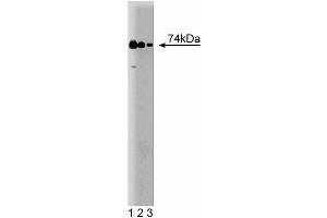 Western blot analysis of RIP on a human endothelial cell lysate. (RIPK1 anticorps  (AA 385-650))