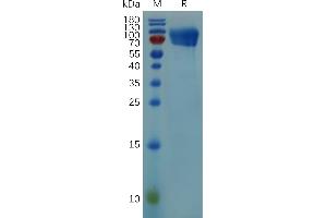 Mouse CD30 Protein, hFc Tag on SDS-PAGE under reducing condition.