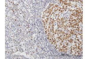 Immunoperoxidase of purified MaxPab antibody to RFC2 on formalin-fixed paraffin-embedded human lymph node. (RFC2 anticorps  (AA 1-320))