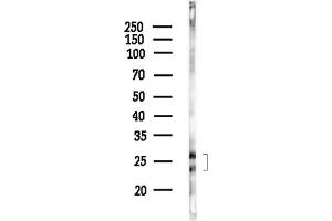 Western blot analysis of lysates from HepG2 cells(starvation,24h treatment), using OAZ2 Antibody at 1/1000 dilution.