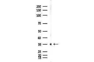 anti-Lactate Dehydrogenase A (LDHA) (C-Term) antibody