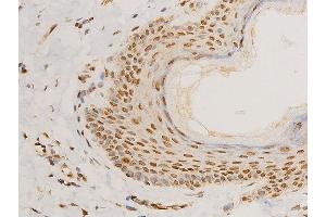 ABIN6267273 at 1/100 staining human skin tissue sections by IHC-P.