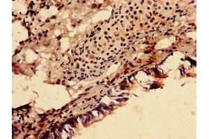 Immunocytochemistry analysis of human lung tissue using ABIN7170882 at dilution of 1:100