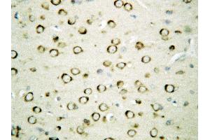 anti-Heat Shock Protein 90kDa beta (Grp94), Member 1 (HSP90B1) (AA 687-700), (Middle Region) antibody