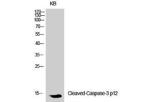 Western Blot analysis of KB cells using Cleaved-CASP3 p12 (D175) Polyclonal Antibody at dilution of 1:1000.
