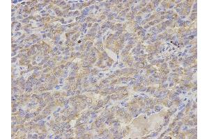 Immunohistochemistry (IHC) image for anti-S100 Calcium Binding Protein A12 (S100A12) antibody (ABIN1876516) (S100A12 anticorps)