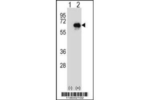 Western blot analysis of CETP using rabbit polyclonal CETP Antibody using 293 cell lysates (2 ug/lane) either nontransfected (Lane 1) or transiently transfected (Lane 2) with the CETP gene. (CETP anticorps  (N-Term))