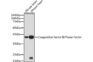 Western blot analysis of extracts of various cell lines, using Coagulation factor III/Tissue Factor antibody (ABIN3021933, ABIN3021934, ABIN3021935 and ABIN6217895) at 1:500 dilution. (Tissue factor anticorps)