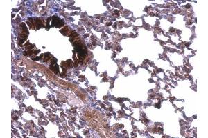 IHC-P Image ATP5A1 antibody [C2C3], C-term detects ATP5A1 protein at membrane on mouse lung by immunohistochemical analysis.