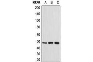 Western blot analysis of CKMT2 expression in THP1 (A), HeLa (B), Jurkat (C) whole cell lysates.