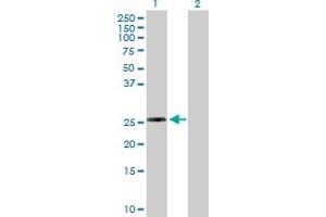 Western Blot analysis of RPL10L expression in transfected 293T cell line by RPL10L MaxPab polyclonal antibody. (RPL10L anticorps  (AA 1-214))