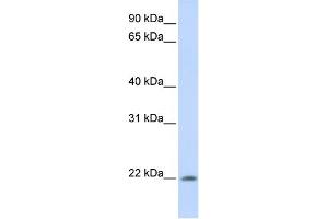 WB Suggested Anti-C2orf28 Antibody Titration: 0. (ATRAID anticorps  (C-Term))