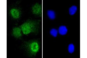 Immunofluorescent analysis of 4 % paraformaldehyde-fixed, 0. (T Antigen (AA 15-43), (N-Term) anticorps)