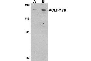 Western Blotting (WB) image for anti-CAP-GLY Domain Containing Linker Protein 1 (CLIP1) (C-Term) antibody (ABIN1030340)