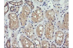 Image no. 1 for anti-Cancer/testis Antigen 1B (CTAG1B) antibody (ABIN1499892) (CTAG1B anticorps)