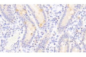 Detection of SCG3 in Human Small intestine Tissue using Polyclonal Antibody to Secretogranin III (SCG3)