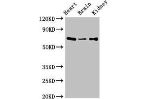 Western Blot Positive WB detected in: Mouse heart tissue, Mouse brain tissue, Mouse kidney tissue All lanes: SLC6A13 antibody at 3 μg/mL Secondary Goat polyclonal to rabbit IgG at 1/50000 dilution Predicted band size: 69, 58, 11 kDa Observed band size: 69 kDa