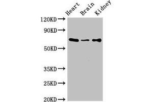 Western Blot Positive WB detected in: Mouse heart tissue, Mouse brain tissue, Mouse kidney tissue All lanes: SLC6A13 antibody at 3 μg/mL Secondary Goat polyclonal to rabbit IgG at 1/50000 dilution Predicted band size: 69, 58, 11 kDa Observed band size: 69 kDa (SLC6A13 anticorps  (AA 1-40))