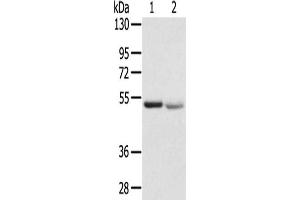 Gel: 8 % SDS-PAGE,Lysate: 40 μg,Lane 1-2: Human placenta tissue, Human normal kidney tissue,Primary antibody: ABIN7192531(SLC8B1 Antibody) at dilution 1/200 dilution,Secondary antibody: Goat anti rabbit IgG at 1/8000 dilution,Exposure time: 1 minute (SLC24A6 anticorps)