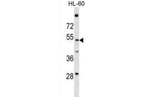 T161A Antibody (N-term) (ABIN1881865 and ABIN2839083) western blot analysis in HL-60 cell line lysates (35 μg/lane).