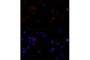 Immunofluorescence analysis of PC-12 cells using Filamin A antibody (ABIN7267206) at dilution of 1:100 (40x lens). (Filamin A anticorps  (C-Term))