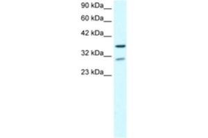 Western Blotting (WB) image for anti-Zinc Finger Protein 385A (ZNF385A) antibody (ABIN2460497) (ZNF385A anticorps)