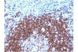 ABIN6383859 to CD79a was successfully used to stain human tonsil sections. (Recombinant CD79a anticorps  (AA 202-216))